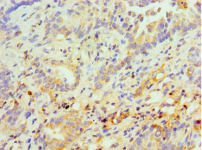 CSB-PA022590ESR1HU