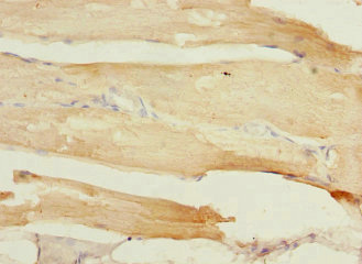 CSB-PA023264ESR1HU