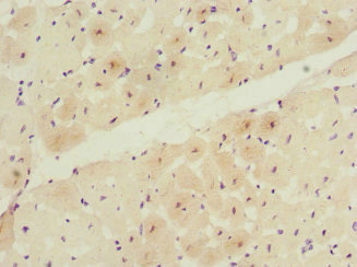 CSB-PA023264ESR1HU