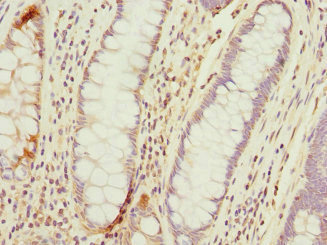 CSB-PA023655ESR2HU