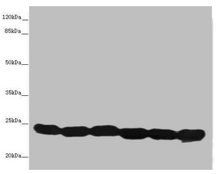 CSB-PA023655ESR2HU