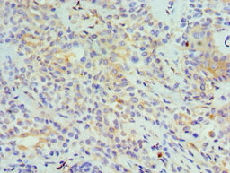 CSB-PA023989ESR1HU