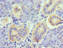 CSB-PA023989ESR1HU
