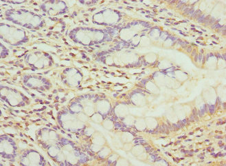CSB-PA237035ESR2HU