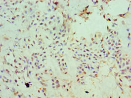 CSB-PA600854ESR2HU