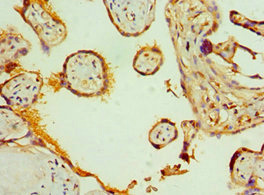 CSB-PA600854ESR2HU