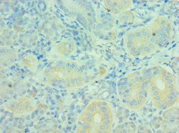 CSB-PA614418ESR1HU