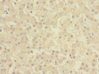 CSB-PA615684ESR2HU
