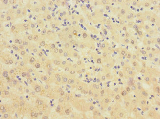CSB-PA615684ESR2HU