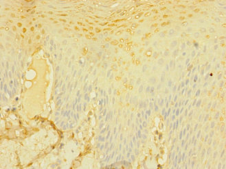 CSB-PA618996ESR2HU