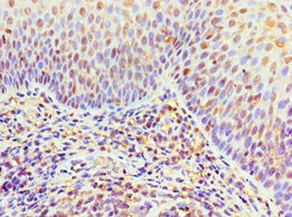 CSB-PA619792ESR2HU