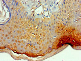 CSB-PA619792ESR2HU