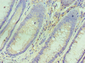 CSB-PA621688ESR2HU