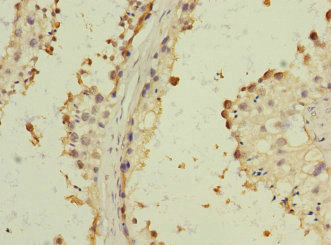CSB-PA734093ESR2HU