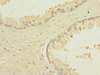 CSB-PA819465ESR2HU