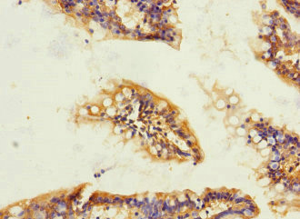 CSB-PA819465ESR2HU