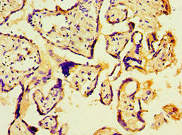 CSB-PA822241DSR1HU
