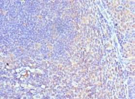 CSB-PA835890ESR1HU