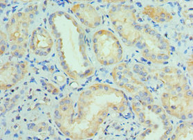 CSB-PA835890ESR1HU