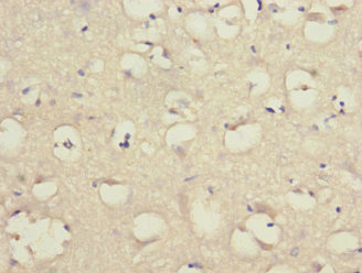 CSB-PA839321ESR2HU