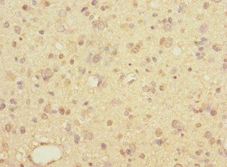 CSB-PA839321ESR2HU