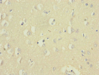 CSB-PA850248ESR1HU