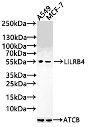 CSB-PA850914ESR2HU