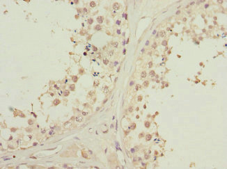 CSB-PA852884ESR2HU
