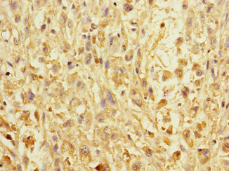 CSB-PA857021ESR1HU