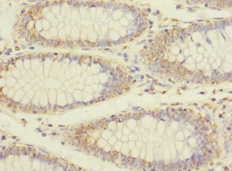 CSB-PA857021ESR1HU