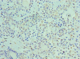 CSB-PA860767ESR1HU