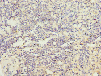 CSB-PA862061ESR2HU