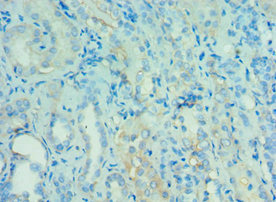 CSB-PA866314ESR2HU