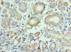 CSB-PA868302ESR1HU