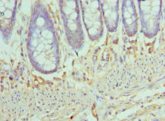 CSB-PA868302ESR1HU