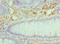 CSB-PA868302ESR1HU