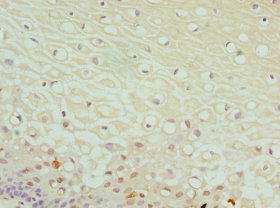 CSB-PA868352ESR2HU