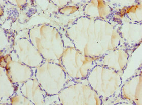 CSB-PA868352ESR2HU