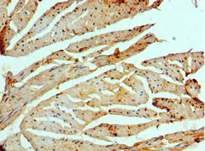 CSB-PA868396ESR1HU