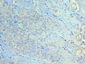 CSB-PA868396ESR1HU