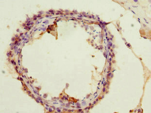 CSB-PA873629ESR2HU