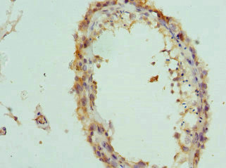 CSB-PA873699ESR2HU