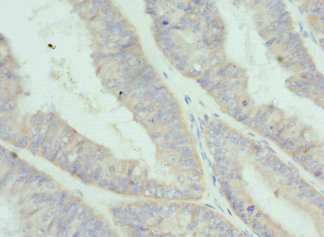 CSB-PA873699ESR2HU