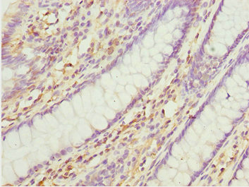 CSB-PA874802ESR2HU