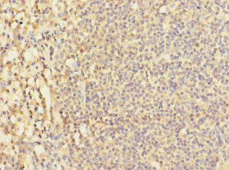 CSB-PA884511ESR2HU