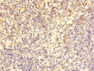CSB-PA884511ESR2HU
