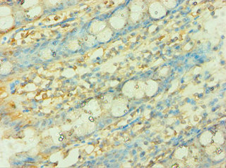CSB-PA885721ESR1HU