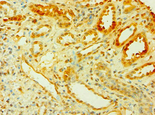 CSB-PA885721ESR1HU
