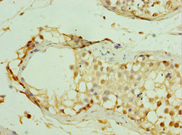 CSB-PA887003DSR2HU