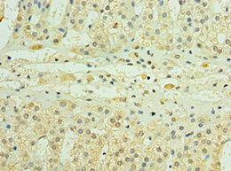 CSB-PA887935ESR2HU